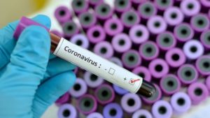 Laborprobe mit Coronavirus - Tests finden derzeit kaum noch statt. - Foto: Bundesregierung