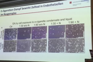 Nach Dampf von E-Zigaretten: Zelltod im Reagenzglas. Mainzer Studie. - Foto: gik