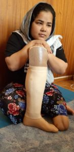 Zenaib aus Afghanistan mit ihrer neuen Unterschenkel-Prothese aus Mainz. - Foto: Trabert