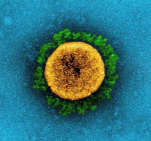 Das Coronavirus B.1.1.7 (Alpha) unter dem Elektronenmikroskop, Alpha ist inzwischen fast schon wieder verdrängt von der neuen Variante Delta. - Foto: von NIAID via Wikipedia