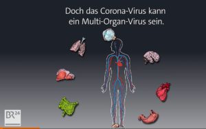 Covid-19 ist, so weiß man heute, eine Multi-Organ-Erkrankung. - Grafik: BR24
